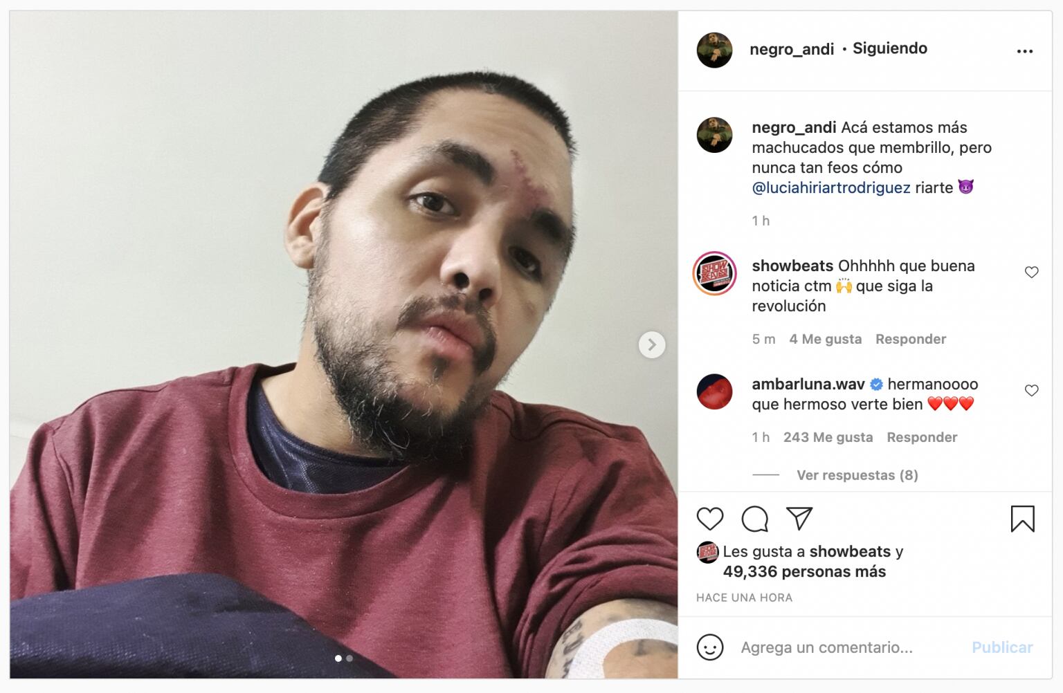 Portavoz reaparece tras su accidente con provocativa frase: Subió fotos de su rostro y luego las borró | Captura Instagram