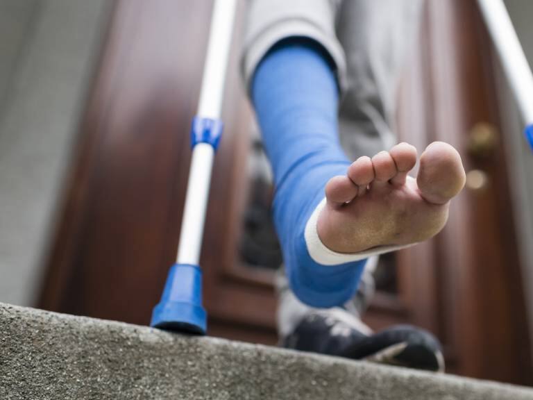 La teoría de los huesos rotos: de qué trata la popular conjetura sobre quienes no han sufrido fracturas en su vida