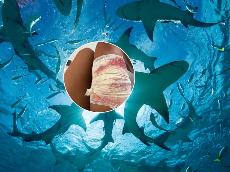 Mordedura tiburón Brasil