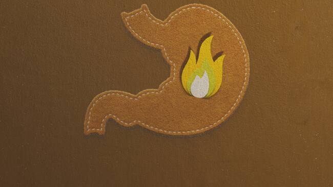 ¿Cuáles son las enfermedades típicas del verano?: El Doctor Chef nos explica