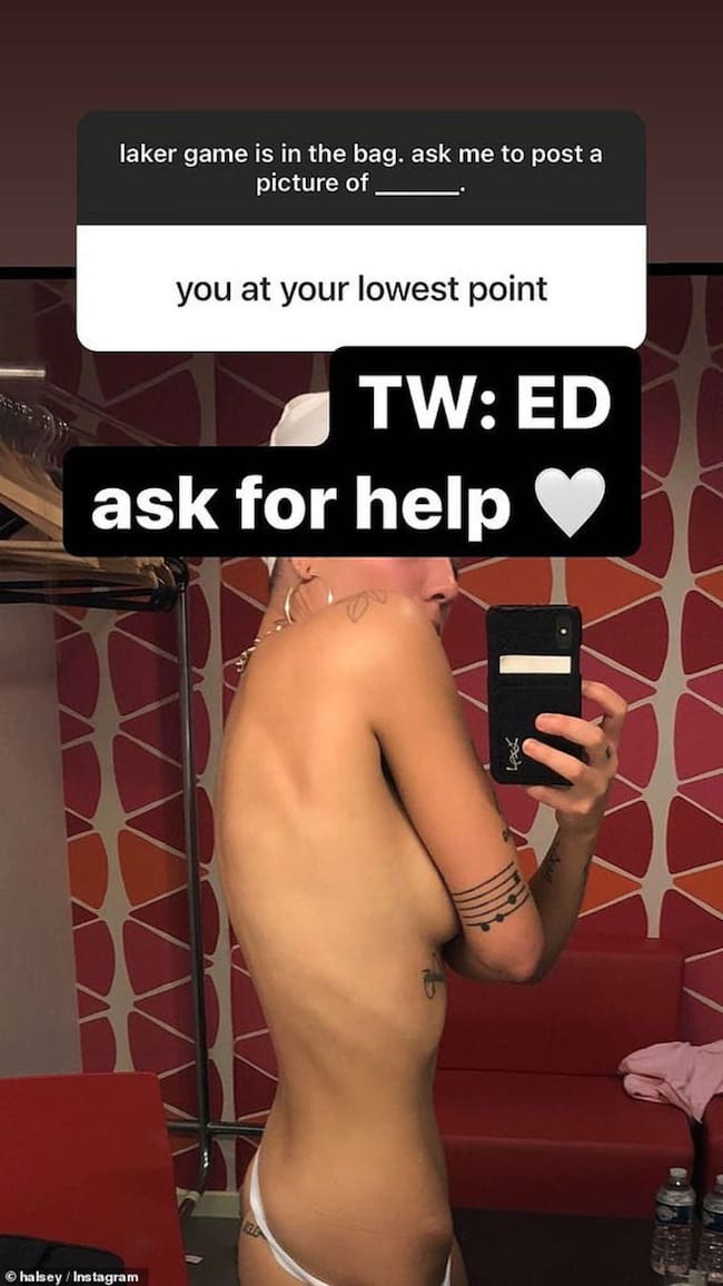ADN