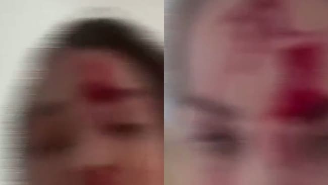 ADN