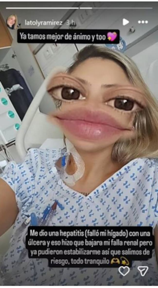 ADN
