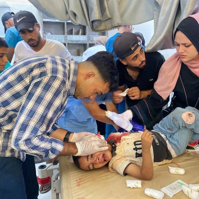 Un niño palestino herido es atendido en un hospital en Gaza luego de que Israel atacara una escuela donde se protegían refugiados en Jan Yunis.